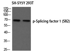 Rabbit Polyclonal Antibody to Splicing factor 1 (Phospho-Ser82)
