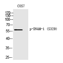 Rabbit Polyclonal Antibody to DNAM-1 (Phospho-Ser329)