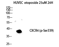 Rabbit Polyclonal Antibody to Fusin (Phospho-Ser339)
