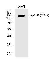 Rabbit Polyclonal Antibody to p12(Phospho-Tyr228)