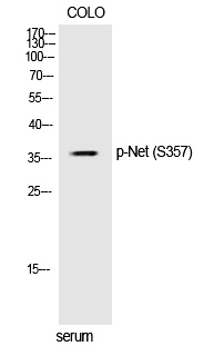 Rabbit Polyclonal Antibody to Net (Phospho-Ser357)