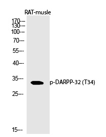 Rabbit Polyclonal Antibody to DARPP-32 (Phospho-Thr34)