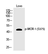 Rabbit Polyclonal Antibody to MOR-1 (Phospho-Ser375)