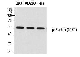 Rabbit Polyclonal Antibody to Parkin (Phospho-Ser131)