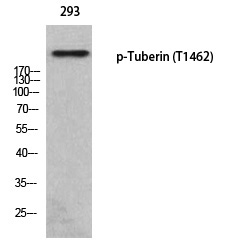 Rabbit Polyclonal Antibody to Tuberin (Phospho-Thr1462)