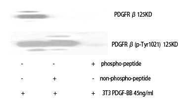Rabbit Polyclonal Antibody to PDGFR-β (Phospho-Tyr1021)