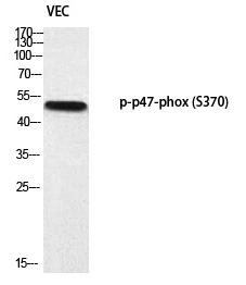 Rabbit Polyclonal Antibody to p47-phox (Phospho-Ser370)