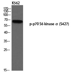 Rabbit Polyclonal Antibody to p7S6 kinase α (Phospho-Ser427)