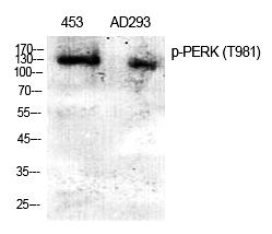 Rabbit Polyclonal Antibody to PERK (Phospho-Thr982)