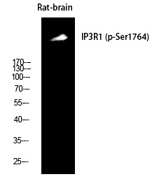 Rabbit Polyclonal Antibody to IP3R-I (Phospho-Ser1764)