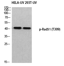 Rabbit Polyclonal Antibody to Rad51 (Phospho-Thr309)