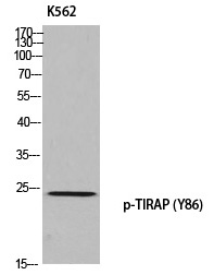 Rabbit Polyclonal Antibody to TIRAP (Phospho-Tyr86)