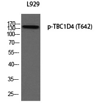Rabbit Polyclonal Antibody to TBC1D4 (Phospho-Thr642)