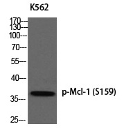 Rabbit Polyclonal Antibody to Mcl-1 (Phospho-Ser159)