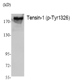 Rabbit Polyclonal Antibody to Tensin-1 (Phospho-Tyr1326)