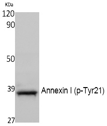 Rabbit Polyclonal Antibody to Annexin I (Phospho-Tyr21)
