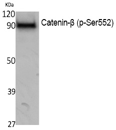 Rabbit Polyclonal Antibody to Catenin-β (Phospho-Ser552)