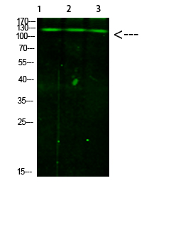 Rabbit Polyclonal Antibody to JAK2/3 (Phospho-Tyr966/939)