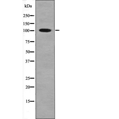 Rabbit Polyclonal Antibody to CTIP (Phospho-Ser327)