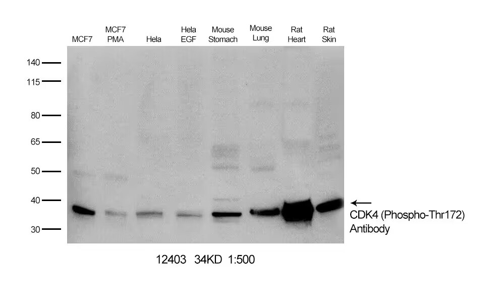 Rabbit Polyclonal Antibody to CDK4 (Phospho-Thr172)