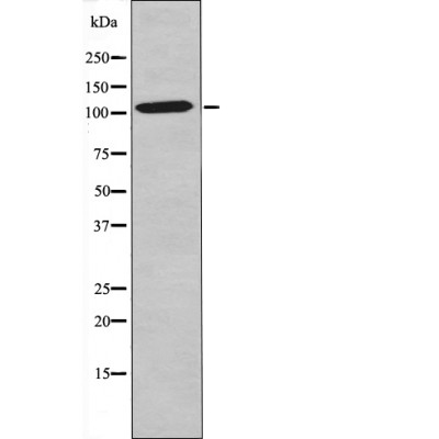 Rabbit Polyclonal Antibody to NF-κB p105 (Phospho-Ser903)