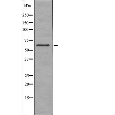 Rabbit Polyclonal Antibody to Chk2 (Phospho-Thr432)