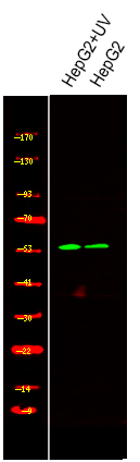 Rabbit Polyclonal Antibody to Smad2 (Phospho-Ser245)