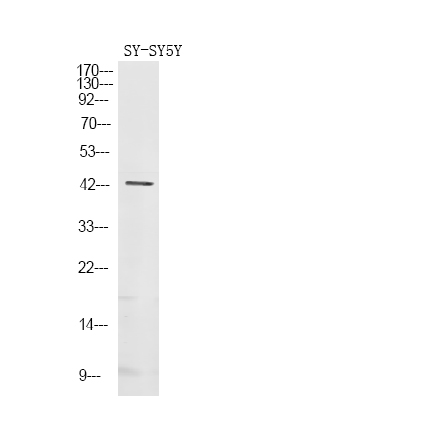 Rabbit Polyclonal Antibody to Gz-α (Phospho-Ser16)
