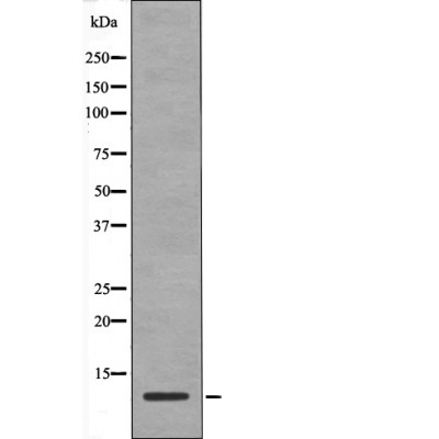 Rabbit Polyclonal Antibody to HMG17 (Phospho-Ser29)