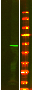 Rabbit Polyclonal Antibody to ILK-1 (Phospho-Ser343)