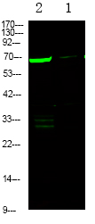 Rabbit Polyclonal Antibody to L-plastin (Phospho-Ser5)