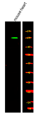 Rabbit Polyclonal Antibody to Kinesin-like Protein KIF1C (Phospho-Ser1092)