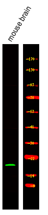 Rabbit Polyclonal Antibody to VAMP4 (Phospho-Ser30)
