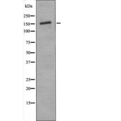 Rabbit Polyclonal Antibody to ASK1 (Phospho-Thr838)