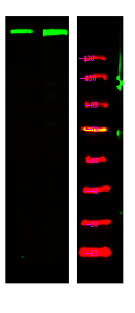 Rabbit Polyclonal Antibody to ATM (Phospho-Ser367)
