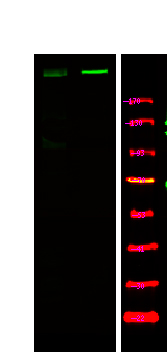 Rabbit Polyclonal Antibody to ATM (Phospho-Ser1893)