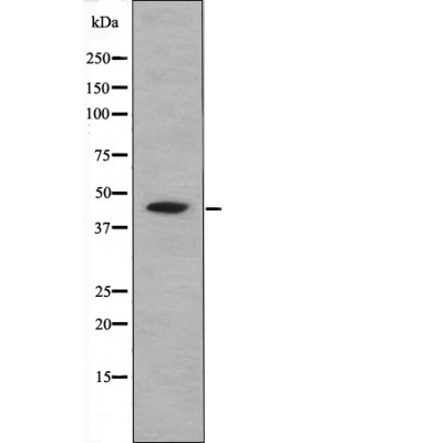 Rabbit Polyclonal Antibody to CREB (Phospho-Ser111)