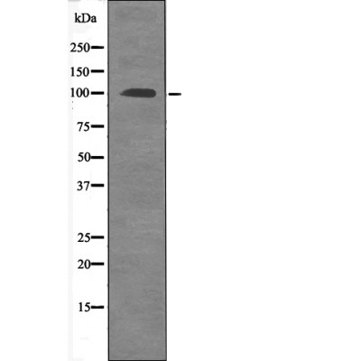 Rabbit Polyclonal Antibody to FKHRL1 (Phospho-Ser315)