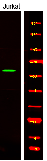 Rabbit Polyclonal Antibody to CAMKK1/2 (Phospho-Ser458/495)