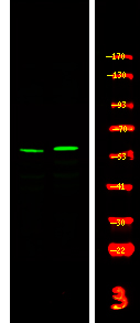 Rabbit Polyclonal Antibody to CSK (Phospho-Tyr304)