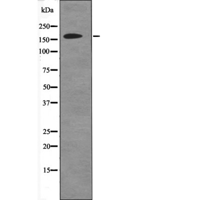 Rabbit Polyclonal Antibody to DAPK1 (Phospho-Ser736)