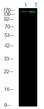 Rabbit Polyclonal Antibody to DAPK1 (Phospho-Ser289)