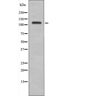 Rabbit Polyclonal Antibody to EPHA8 (Phospho-Tyr838)