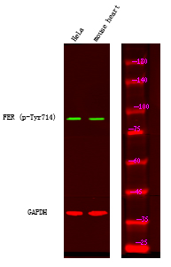 Rabbit Polyclonal Antibody to FER (Phospho-Tyr714)