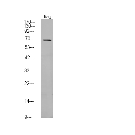 Rabbit Polyclonal Antibody to FGR (Phospho-Tyr412)