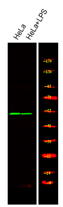 Rabbit Polyclonal Antibody to MST3 (Phospho-Thr18)