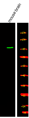 Rabbit Polyclonal Antibody to PKG2 (Phospho-Ser126)