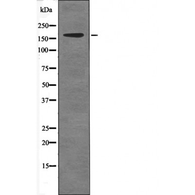 Rabbit Polyclonal Antibody to c-Ret (Phospho-Tyr981)