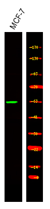 Rabbit Polyclonal Antibody to Retinoic Acid Receptor α/β (Phospho-Ser96)
