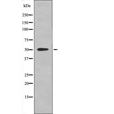 Rabbit Polyclonal Antibody to RXR-α (Phospho-Ser260)